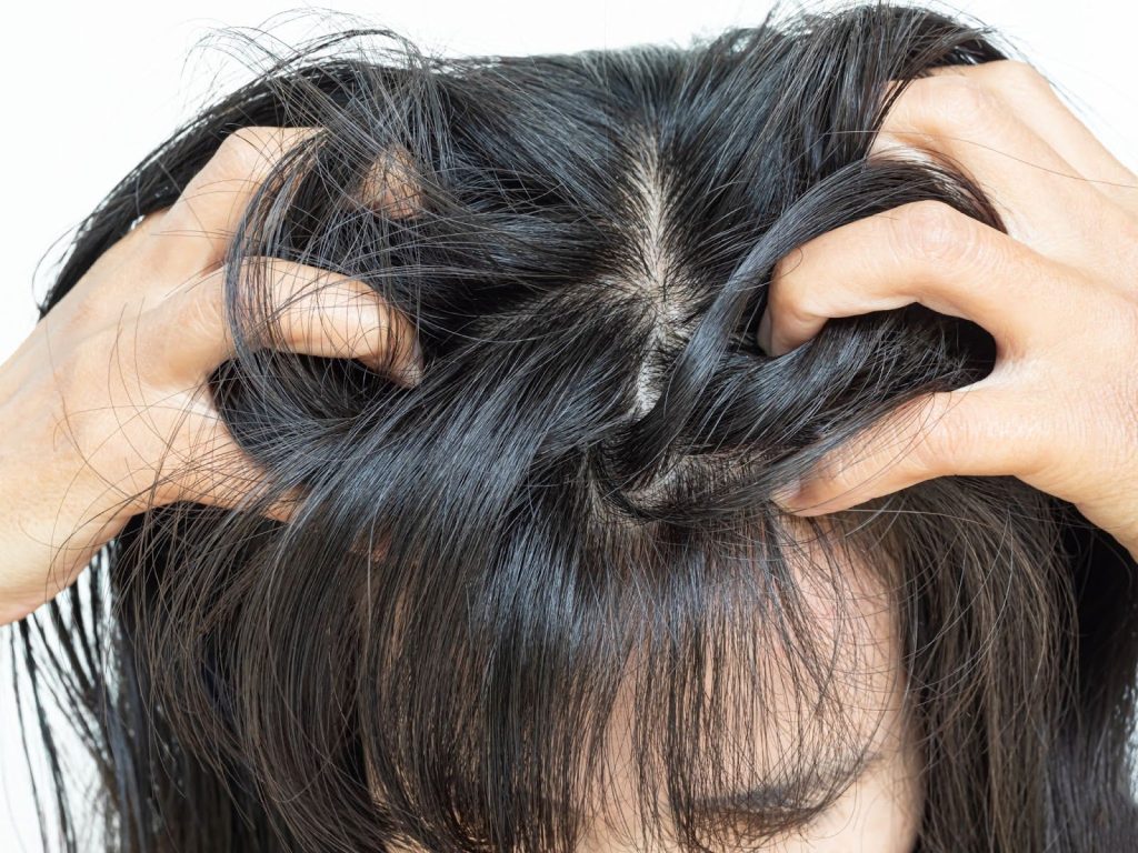 A dry scalp can cause itchiness and irritation